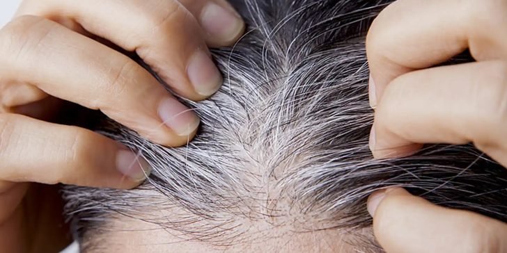 Canas: Como puedes prevenirlas y así evitar la necesidad de teñirlas