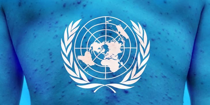 La OMS declara una emergencia global de salud por la viruela del mono